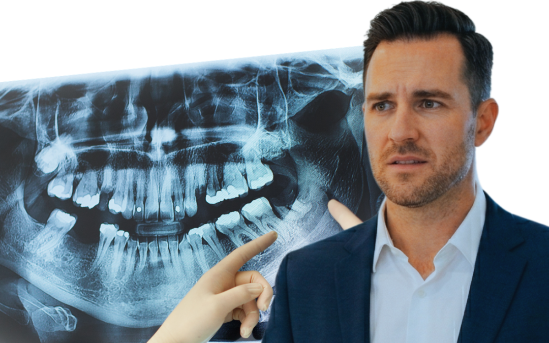 ejecutivo preocupado, radiografía dental