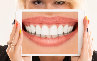 ¿Diseño de sonrisa o una sonrisa que realmente funcione? Lo que debes saber antes de tomar una decisión