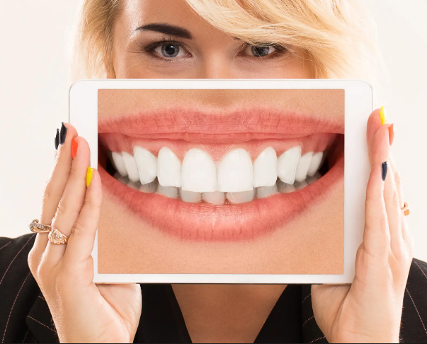 diseño de sonrisa